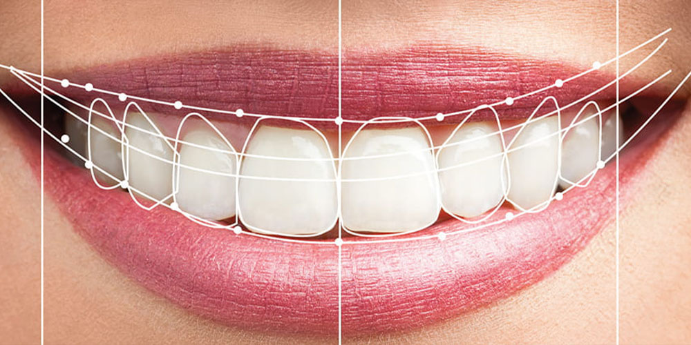 Unveiling Your Dream Smile: A Comprehensive Guide to Smile Design with Dr. Srinath’s Dental Zone